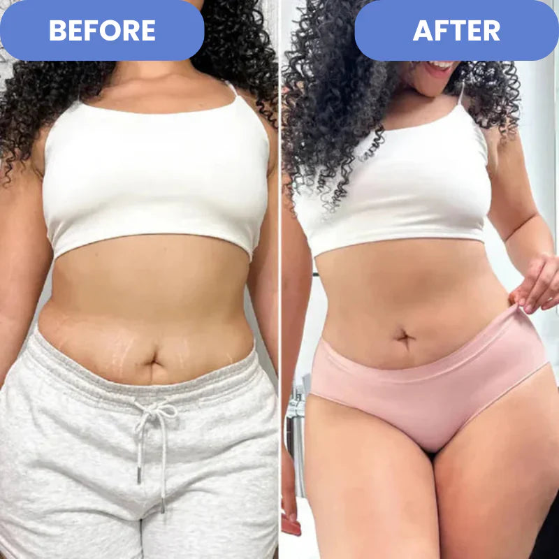 Anti-Cellulite Massager